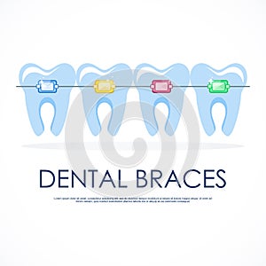 Healthy well-groomed teeth in braces. Dentistry and oral care