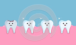 Healthy white teeth and damaged darkened tooth with hole. children dentistry sad character. Dental Infographic elements concept