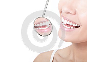 Healthy woman teeth and a dentist mouth mirror