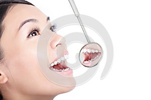 Healthy woman teeth with a dentist mouth mirror
