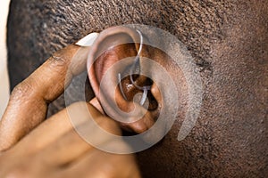 Hearing Aid And Audiology. Handicap photo