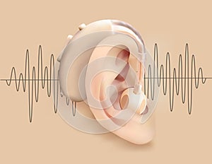 Hearing aid behind ear. Ear and sound amplifier on background of sound wave pattern. Deafness and hearing loss