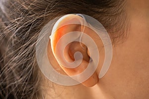 Hearing Aid Deaf Ear Audiology photo