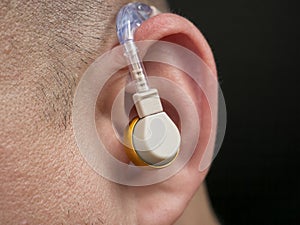 Hearing aid in the ear of a man with suffering from deafness and hearing impairment