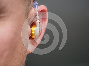 Hearing aid in the ear of a man with suffering from deafness and hearing impairment