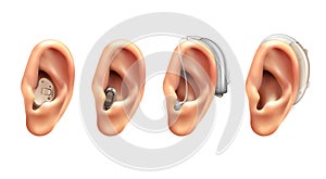 Hearing Aid Realistic Set