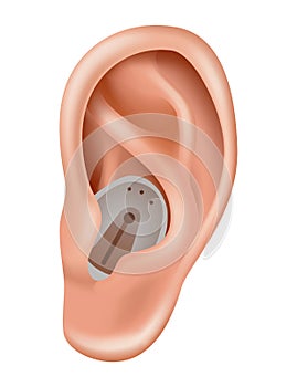 Hearing aid. Sound amplifier for patients with hearing loss. Medicine and health. Realistic object behind the ear