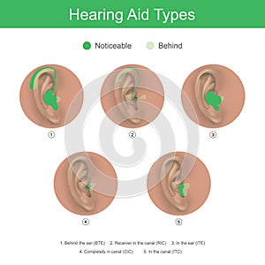 Hearing Aid Types. Health care products.