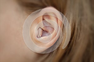 Hearing aid in your ear close-up