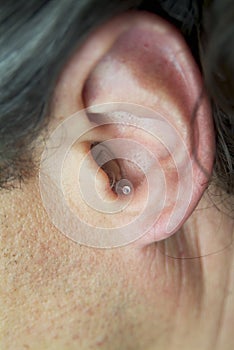 Hearing device