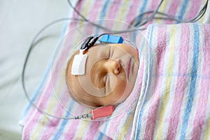 Hearing test of a sleeping newborn at hospital