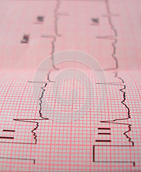 Heart analysis