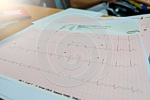 Heart analysis, electrocardiogram graph ECG