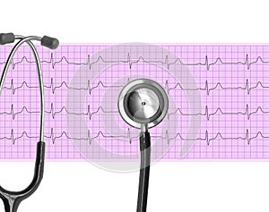 Heart analysis, electrocardiogram graph (ECG)