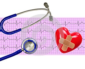 Heart analysis, electrocardiogram graph (ECG)