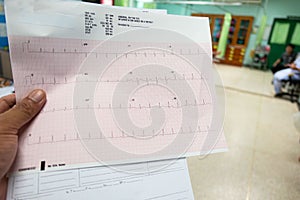 Heart analysis, electrocardiogram graph ECG in hand doctor at the hospital
