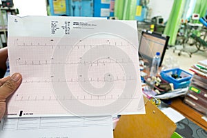 Heart analysis, electrocardiogram graph ECG in hand doctor at the hospital