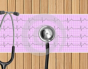 Heart analysis, electrocardiogram graph (ECG) and Stethoscope on