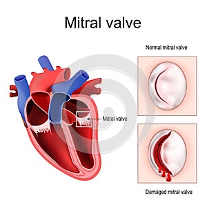 Heart anatomy. Mitral valve