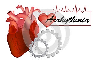 Heart arrhythmia or irregular heartbea photo