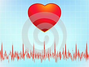 Heart attack electrocardiogram-ecg. EPS 8