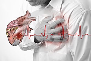 Heart attack and heart beats cardiogram photo