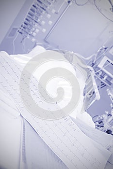 Heart attack in the ICU. ECG of heavy patient