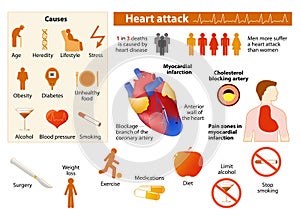 Heart attack infographic photo