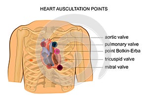 Heart auscultation points photo