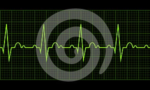 Heart beat. Cardiogram. Cardiac cycle