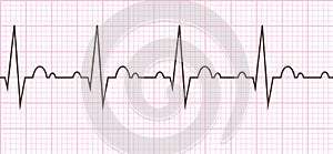Heart beat. Cardiogram. Cardiac cycle photo