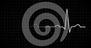 Heart beat EKG monitor white