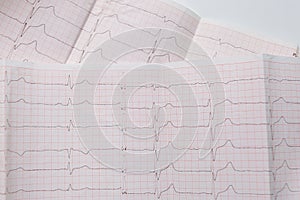 Heart cardiogram, electrocardiograph readings