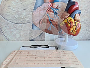 Heart cardiovascular disease and electrocardiogram of patient