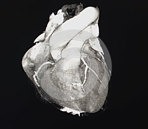 Heart Computed Tomography