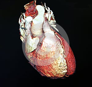 Heart Computed Tomography