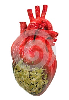 Heart disease concept, 3D rendering