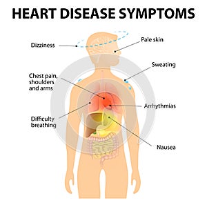 Heart Disease Symptoms