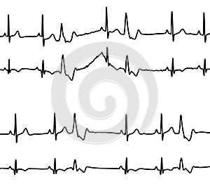 Heart diseases graphs