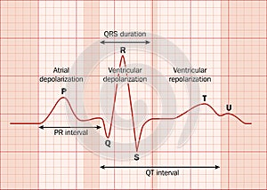 Heart ECG