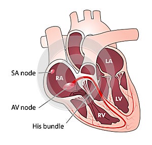 Corazón eléctrico gestión 