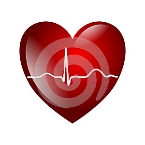 Heart electrocardiogram