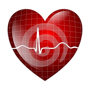 Heart electrocardiogram
