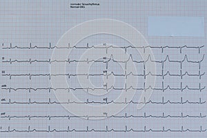 Heart examination with EKG