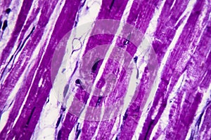 Heart hypertrophy, light micrograph