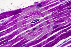 Heart hypertrophy, light micrograph