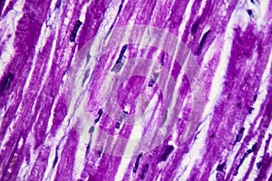 Heart hypertrophy, light micrograph photo