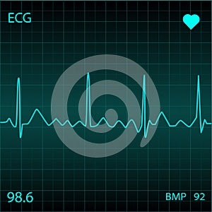 Heart Monitor