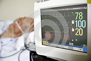 Monitor cardíaco en el hospital de la UCI.