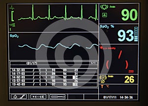 Heart monitor